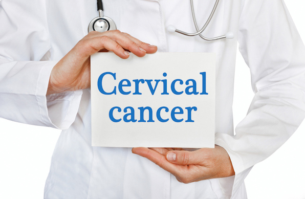 Cervical Cancer: What You Need To Know Cervical Cancer: What You Need To Know