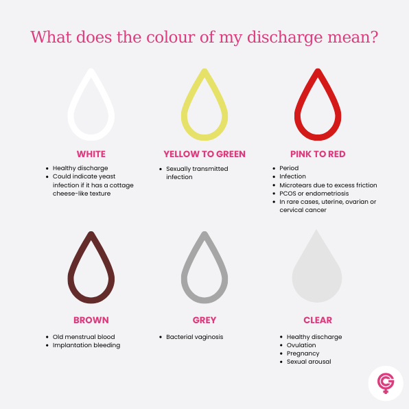 Vaginal Discharge – What’s Normal? | The Gynae Centre