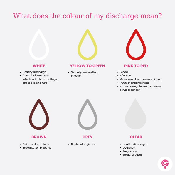 Vaginal discharge: What is normal and when should I be concerned