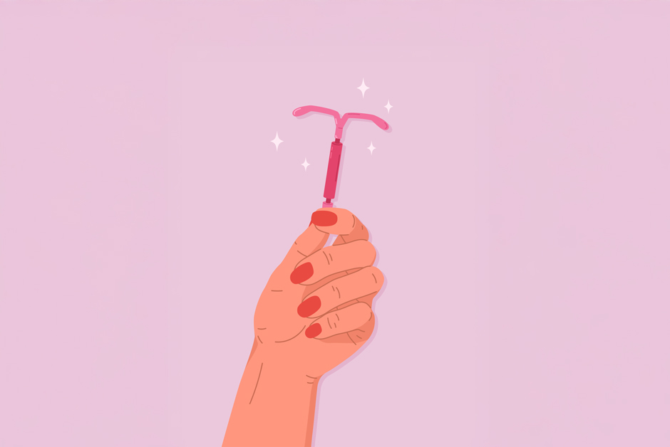 IUD Coil Insertion: Is It Painful? What To Expect