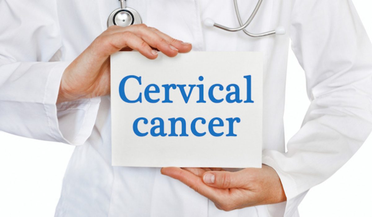 Cervical Cancer: What You Need To Know