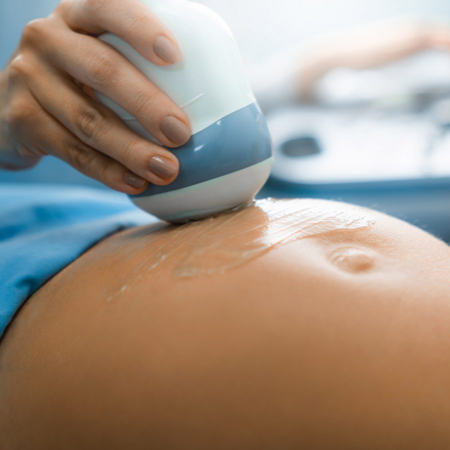 Early pregnancy scans at The Gynae Centre Early pregnancy scans at The Gynae Centre